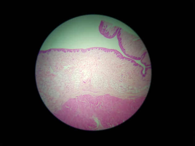 Stratified Squamous Epithelium Slides - Stratified Squamous Epithelium 02 40X